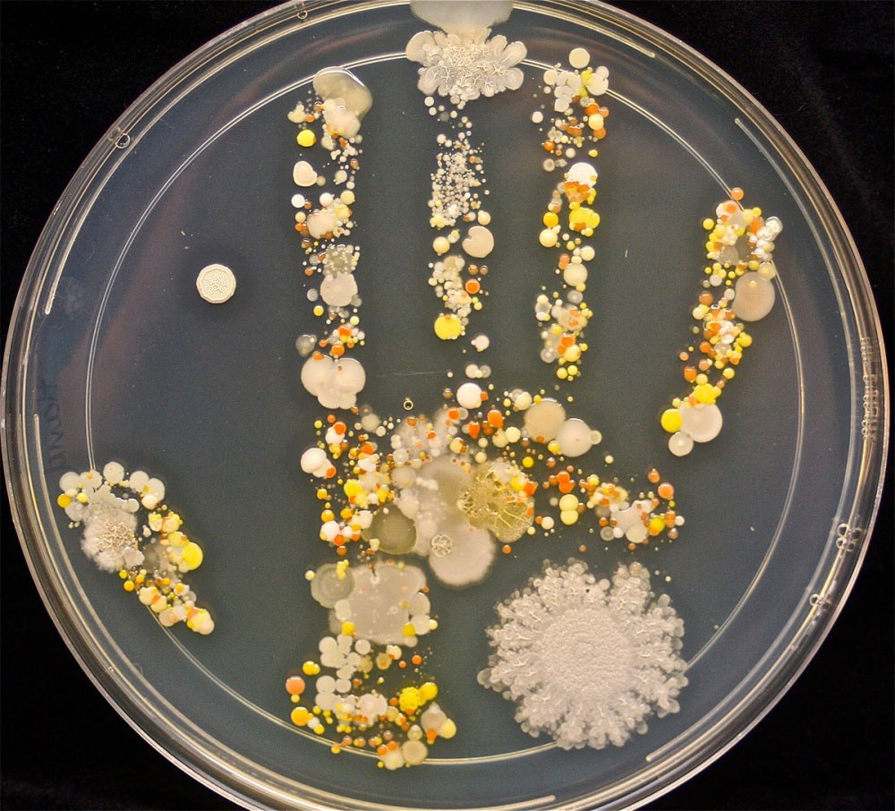 бактерии на руках фото